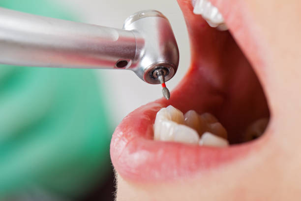 Best Walk-In Emergency Dentist in Corcoran, CA
